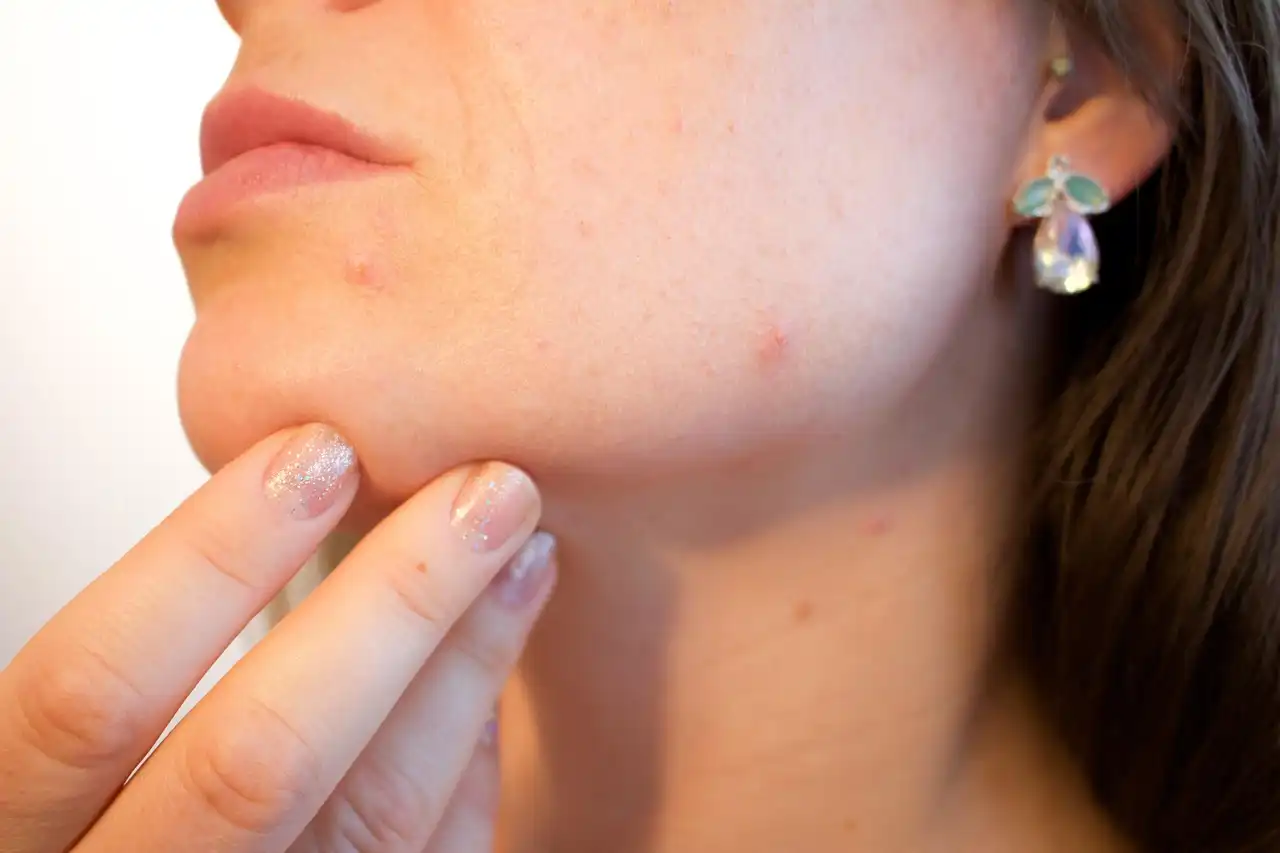 Skin Health: When to See a Pharmacist vs Your GP